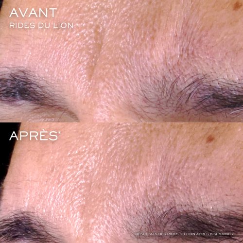 LANCÔME-Rénergie C.R.x. Triple Sérum Rétinol Sérum visage LANCÔME-Rénergie C.R.x. Triple Sérum Rétinol Sérum visage